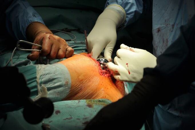 Tratament chirurgical