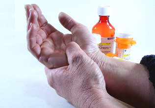 metode de tratare a artritei și artrozei