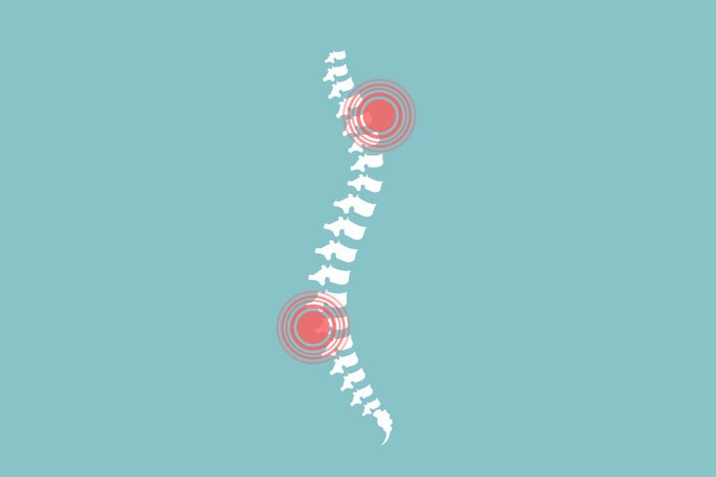 coloana vertebrală umană și durerile de spate