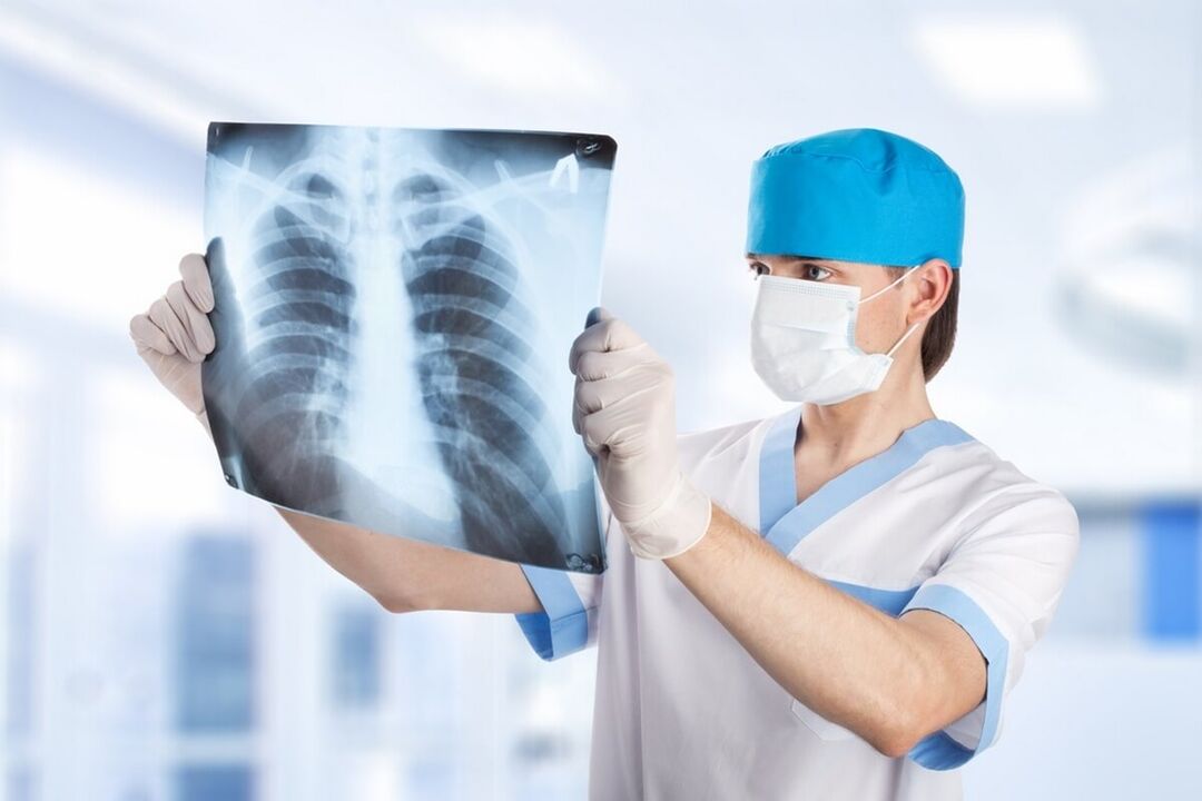 Radiografia toracică cu osteocondroză