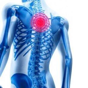 dureri de spate în osteocondroza toracică