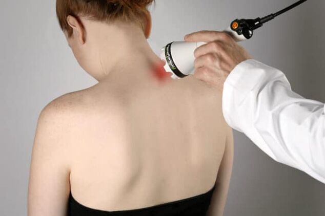 Terapia cu laser este utilizată pentru a combate durerile de spate în zona omoplatului. 